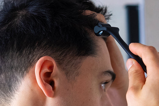 6 Reasons Why a Dermaroller Can Contribute to Hair Growth in Men