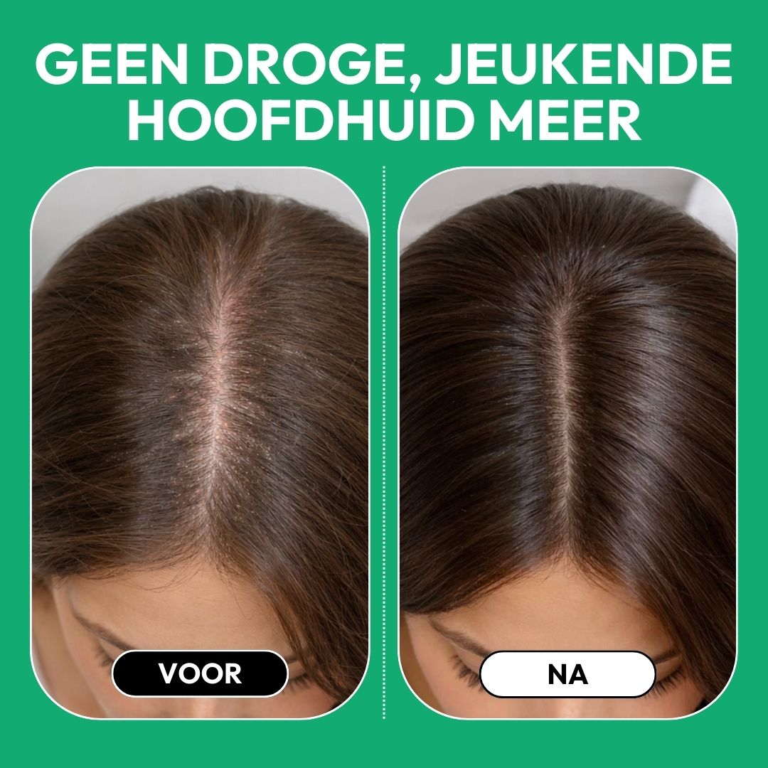 Hair Growth Stimulation Serum