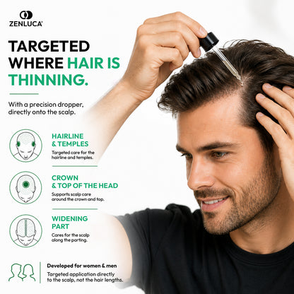 Man applying ZENLUCA Hair Growth Stimulating Serum with a precision dropper to the hairline, crown and widening part